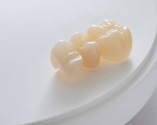 Dental crown and bridge restoration